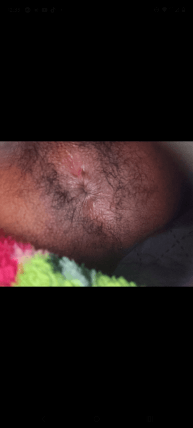 Cuzinho apertadinho gostoso