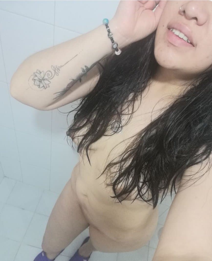 Ana ex alumna de la Unitec Campus Sur quemada por su esposo