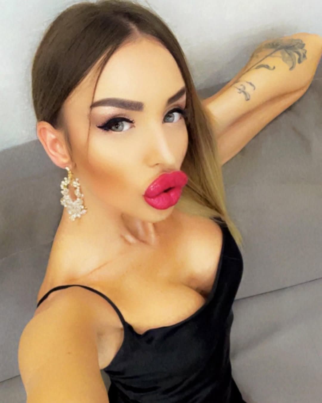 Huge Bimbo Duck Lips