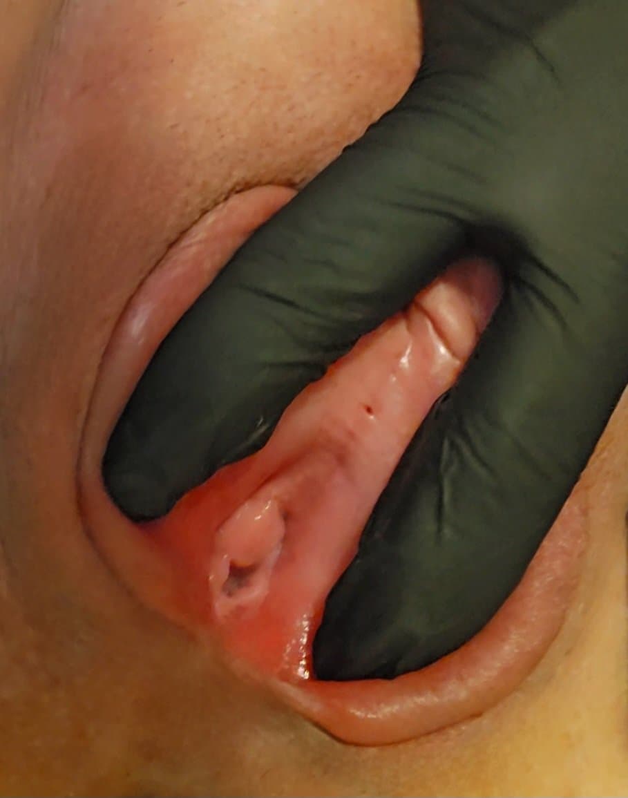 Click to view full size Charlotte spreading her meaty swollen pussy hole. Her KIK: LickMySwollenPus