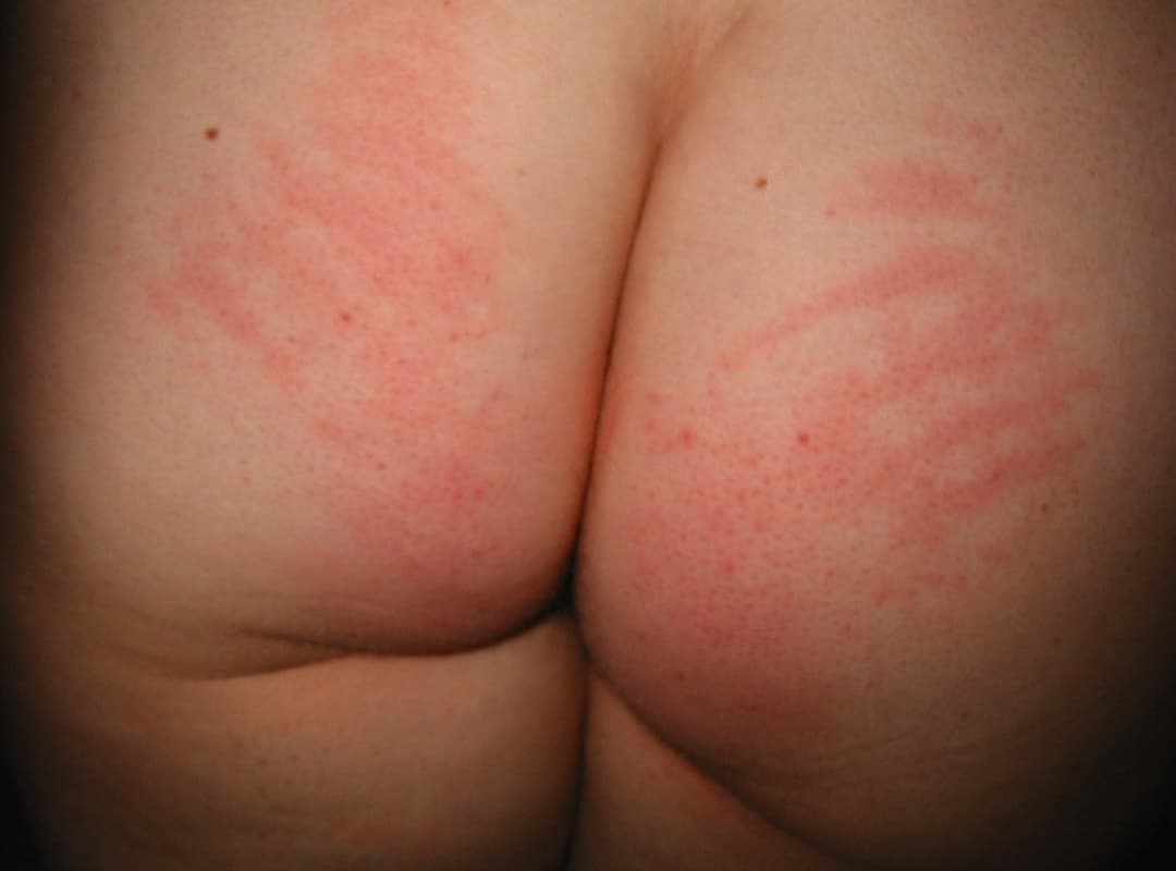 Click to view full size Spanked ass of my german chubby wife
