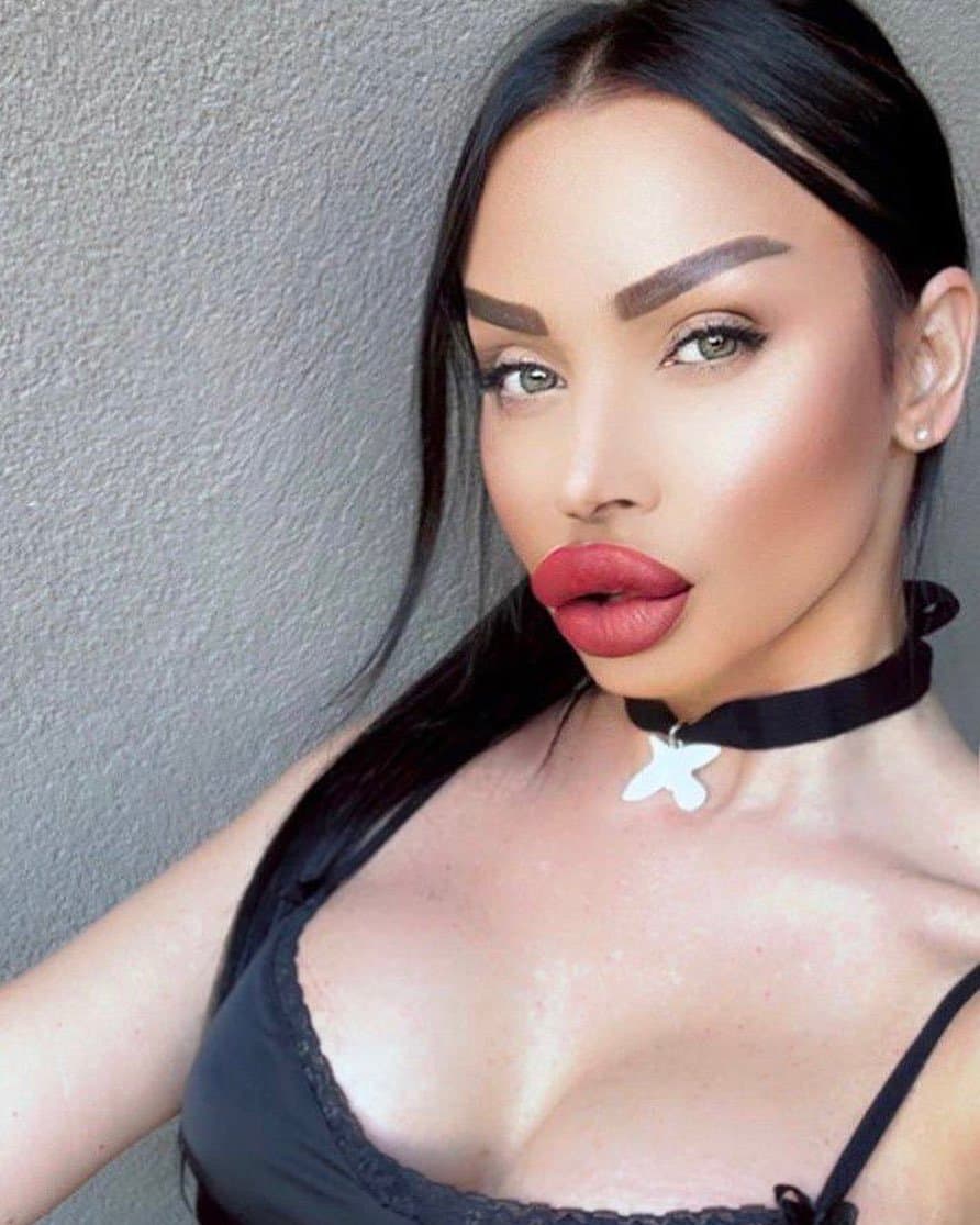 Huge Bimbo Duck Lips