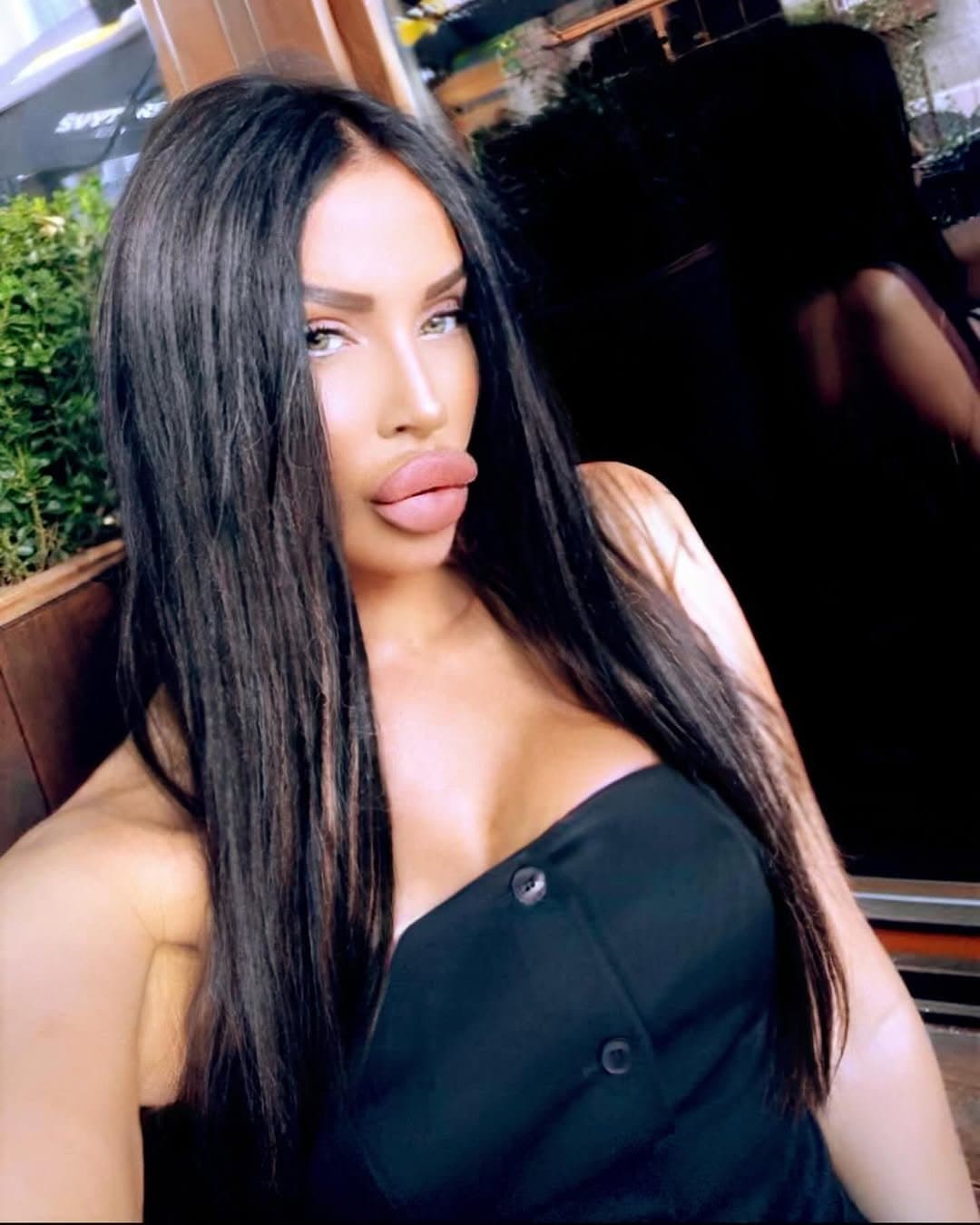 Huge Bimbo Duck Lips