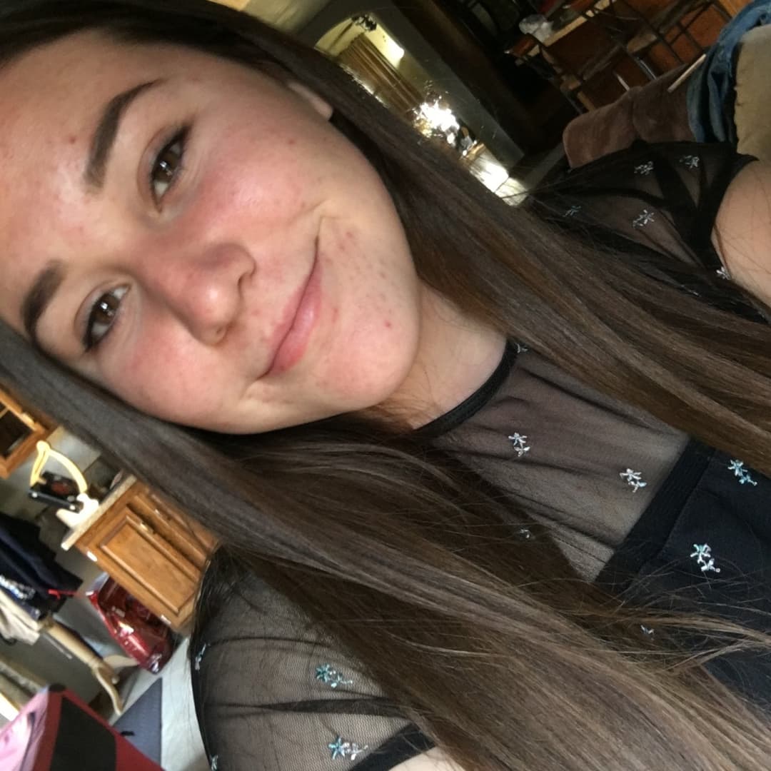 Innocent pimple face w tight pussy and smelly asshole