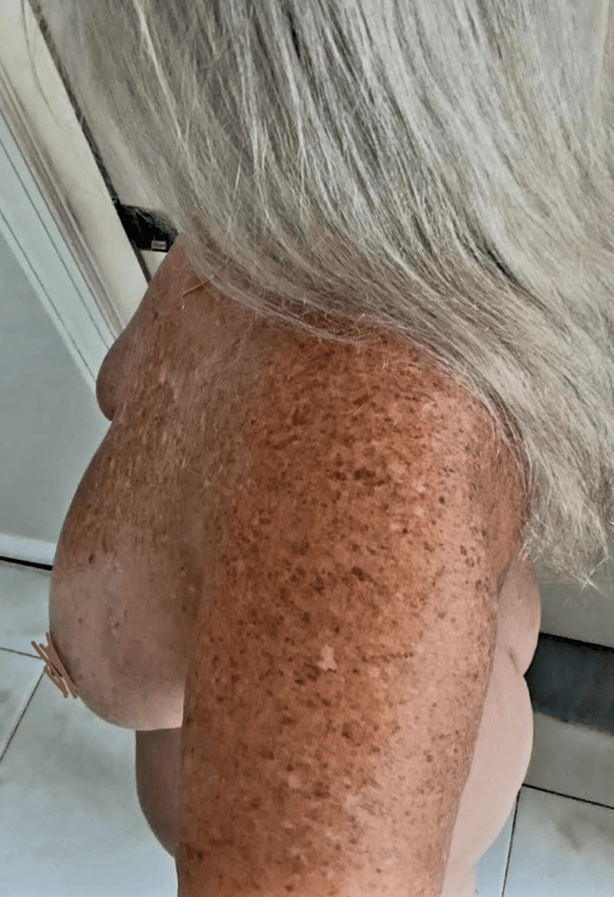 Old Women (001): A Old Naked Sunshine