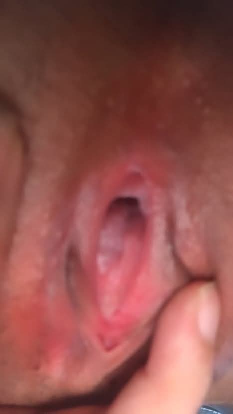 Tổng hợp - Collections