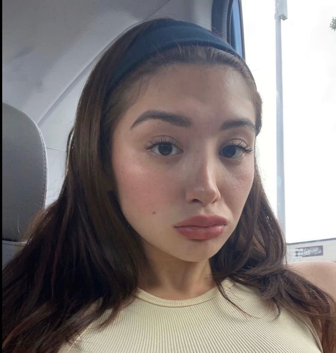 Duck lips pouting teens dsl