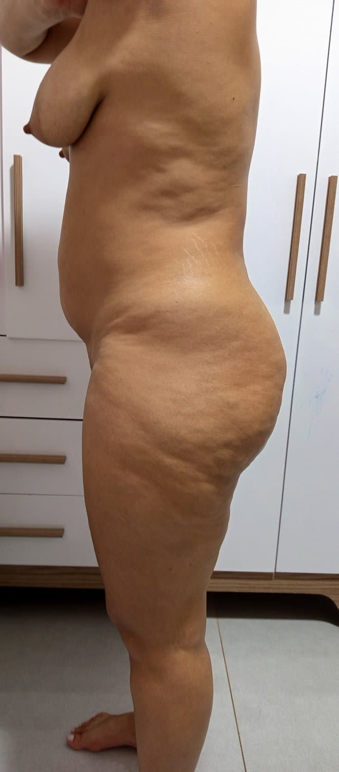 Celulite da esposa (pedidos)