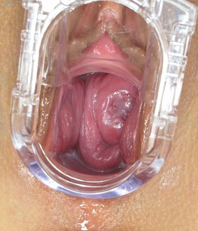 Speculum Play inside-a-horny-brunette-vagina aus dem web