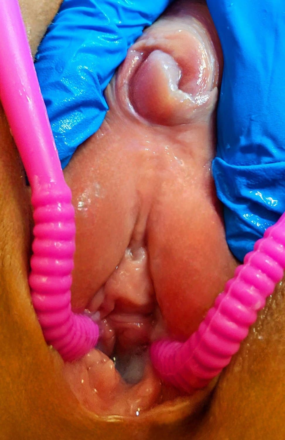 Charlotte spreading her meaty swollen pussy. KIK: LickMySwollenPus