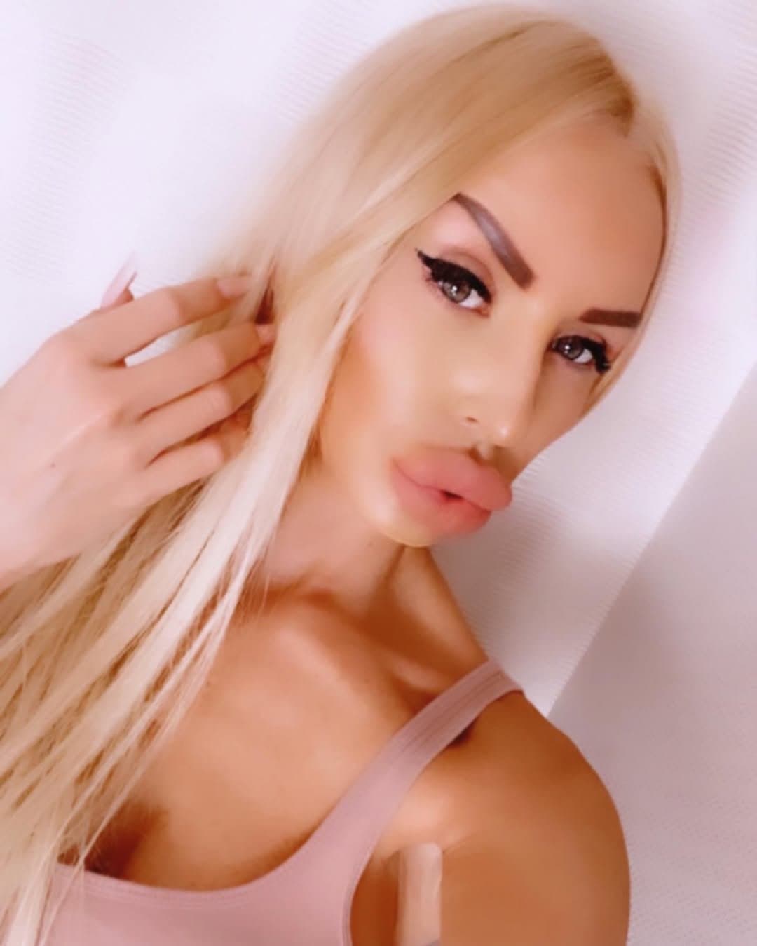 Huge Bimbo Duck Lips