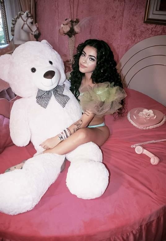 Click to view full size MALU before surgery