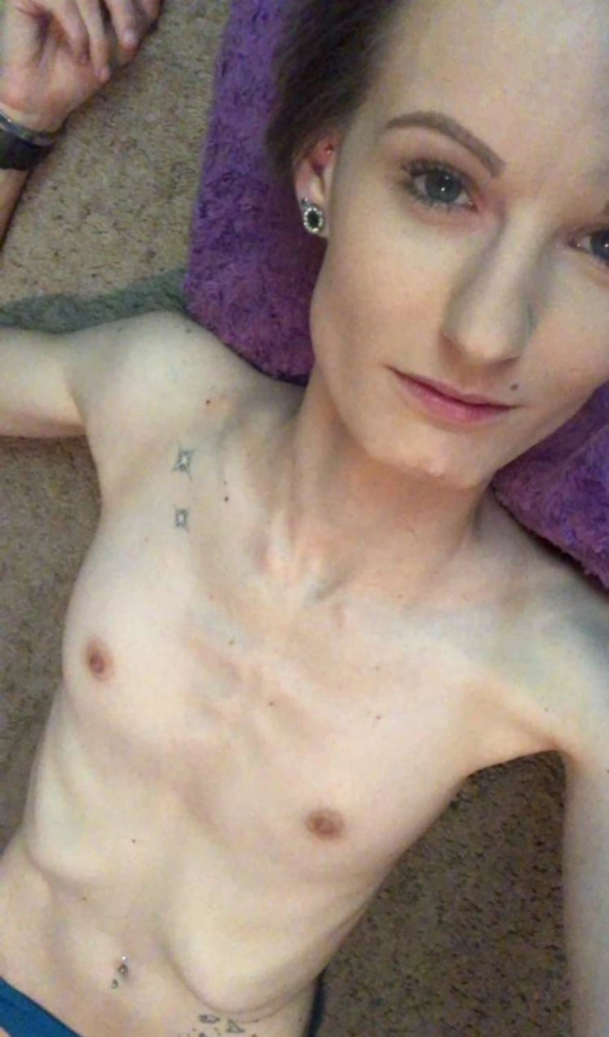 Anorexic Amanda F. and her bald bulging pussy on full display ?