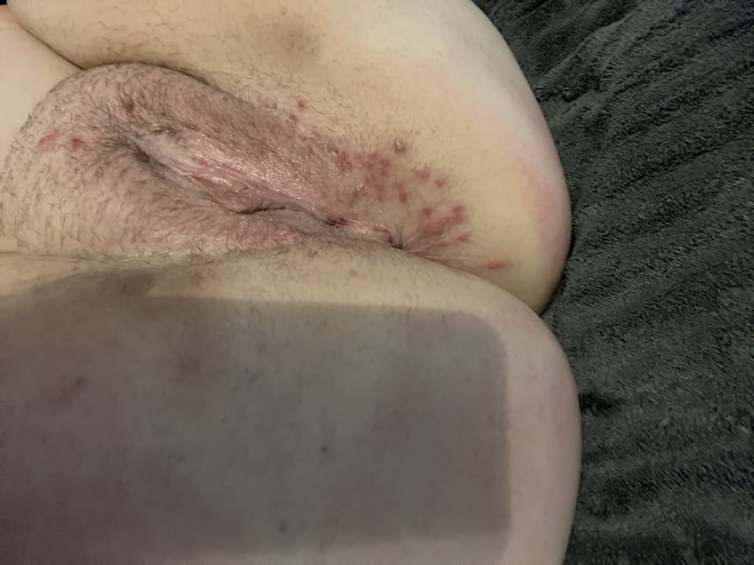 Click to view full size Flabby Abby bred by her Uncle!! Kik: mygirl4usecny