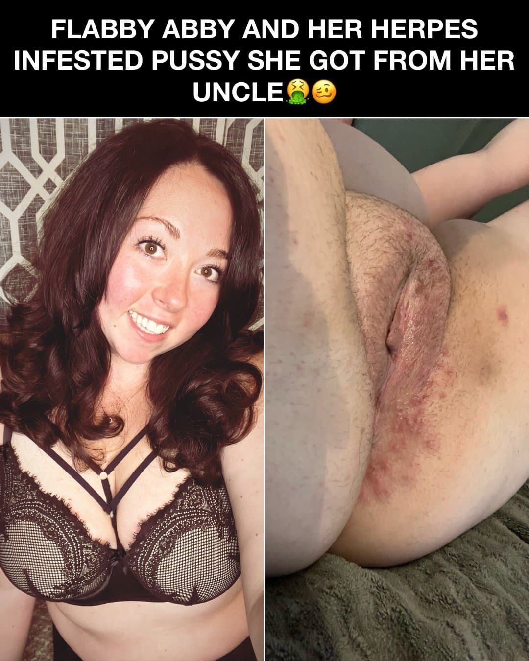 Click to view full size Flabby Abby bred by her Uncle!! Kik: mygirl4usecny