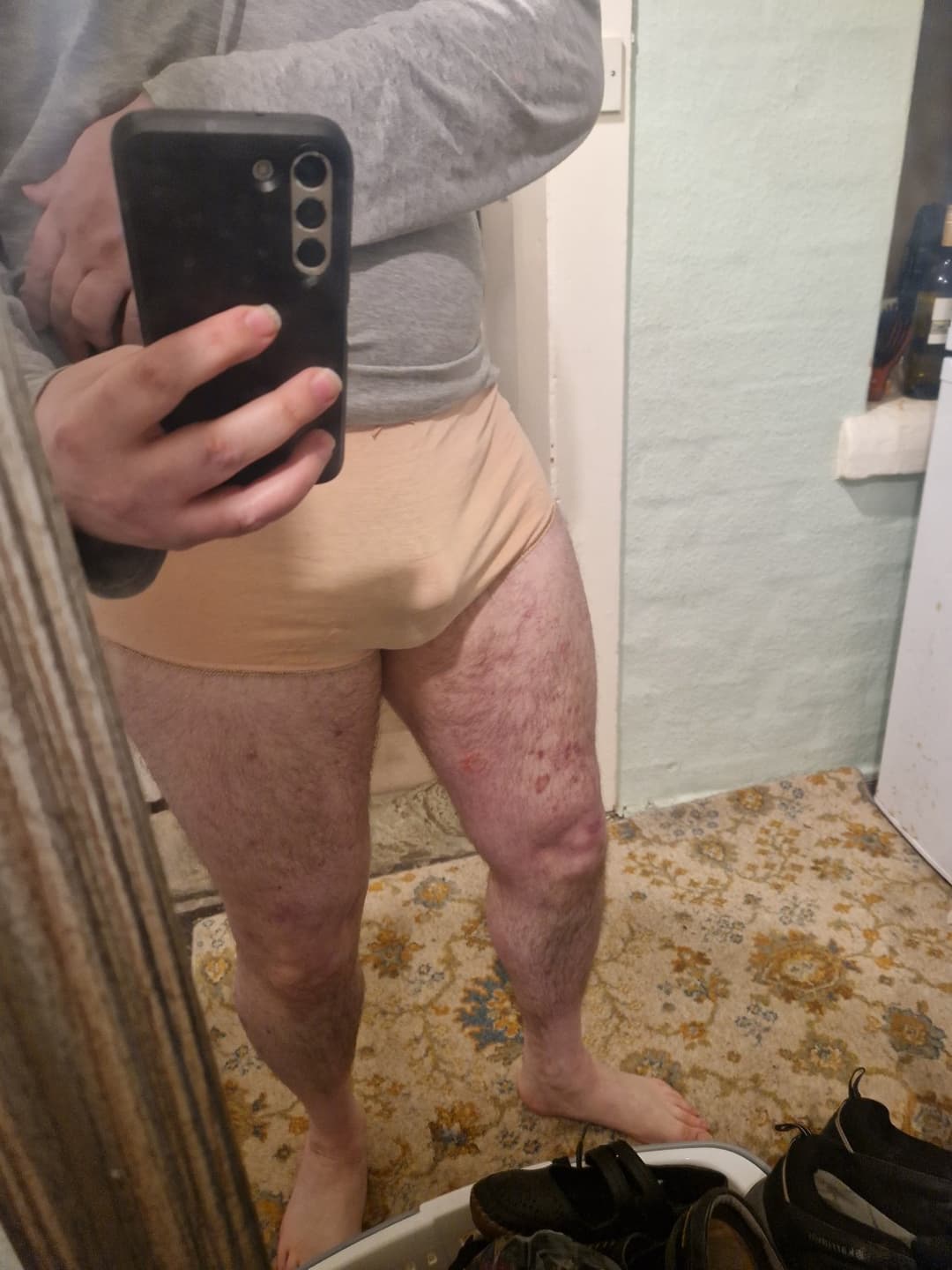 Tiny Dicked Chris from UK - PERV