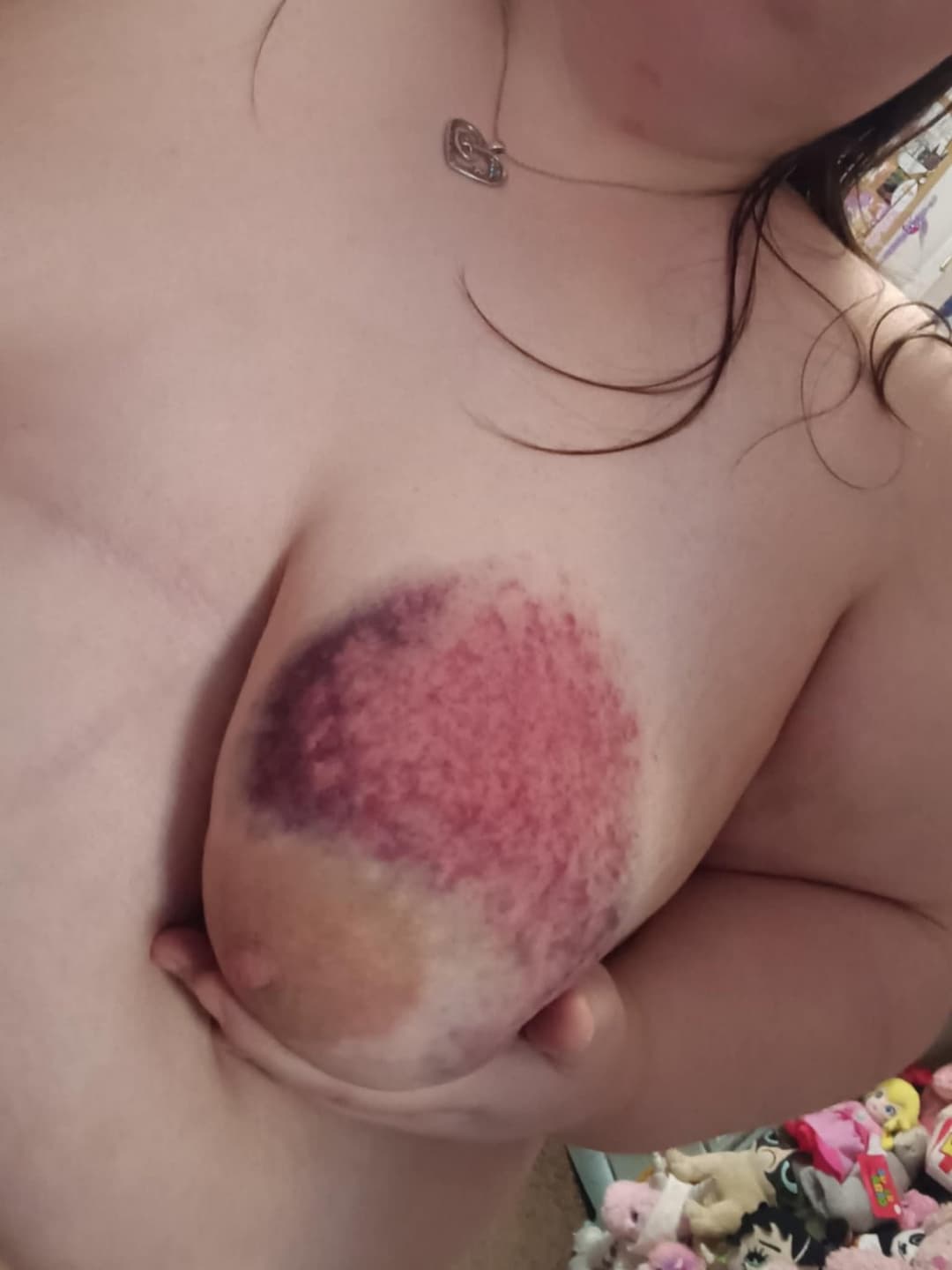 Heavy BDSM Brusing Over A Week