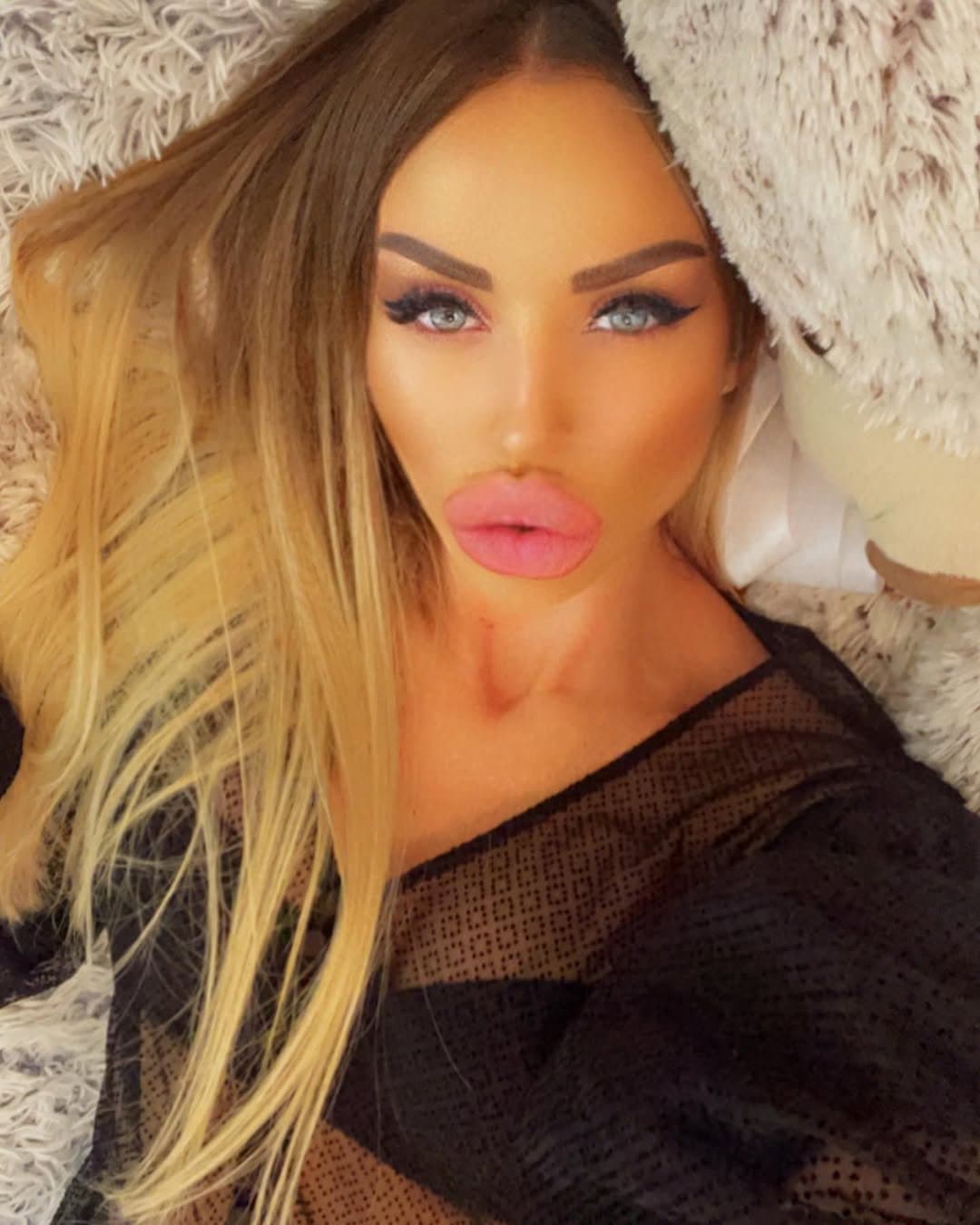 Huge Bimbo Duck Lips