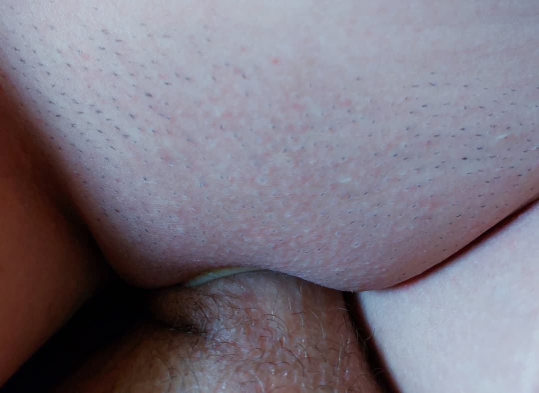 Small fucking picture previews xD