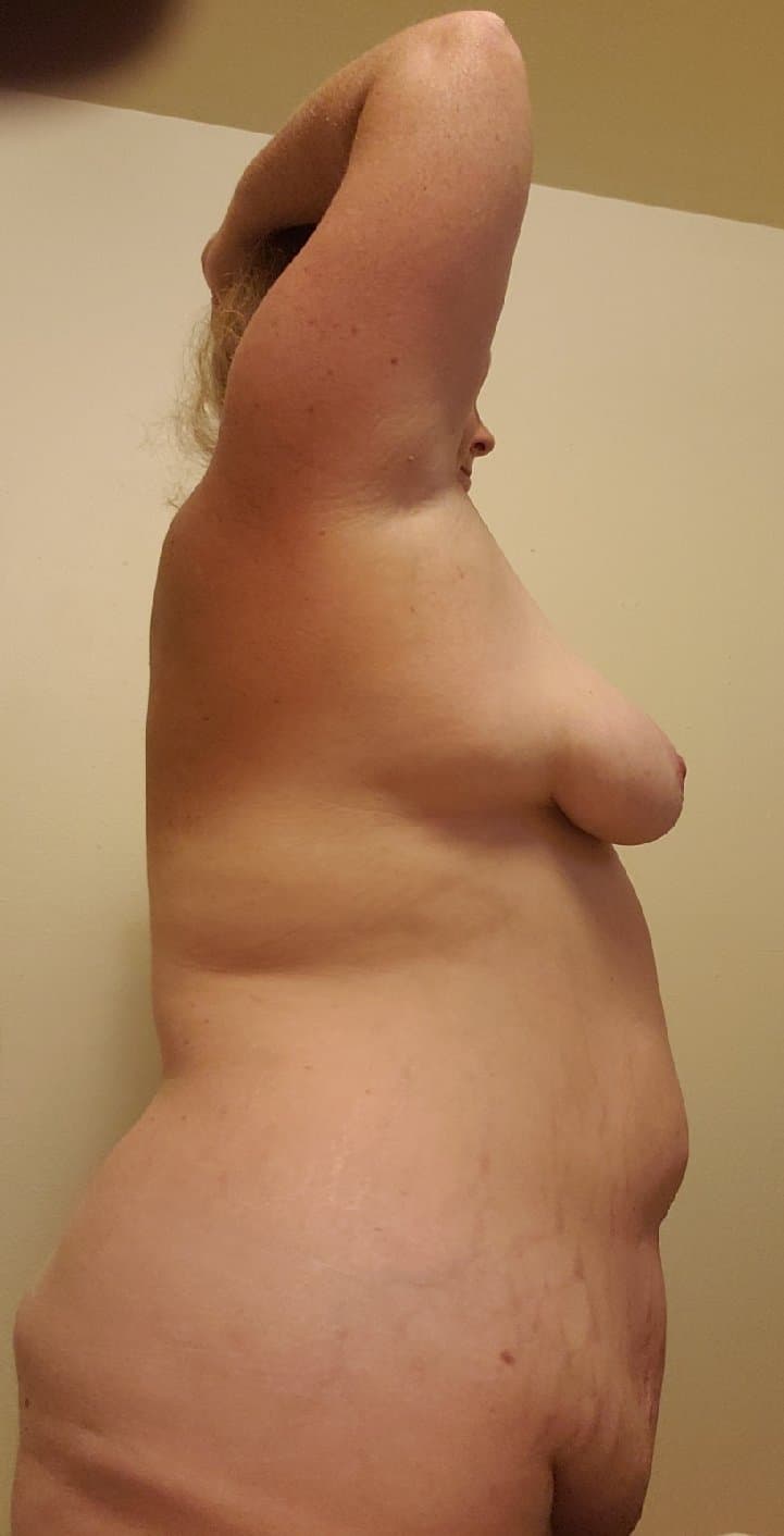 Desperate Tits call for Desperate measures