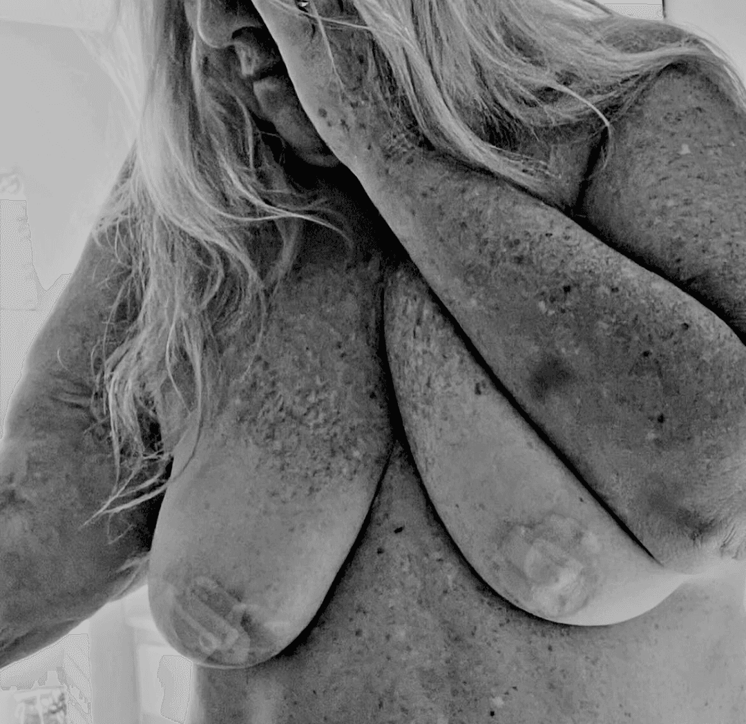 Old Women (001): A Old Naked Sunshine