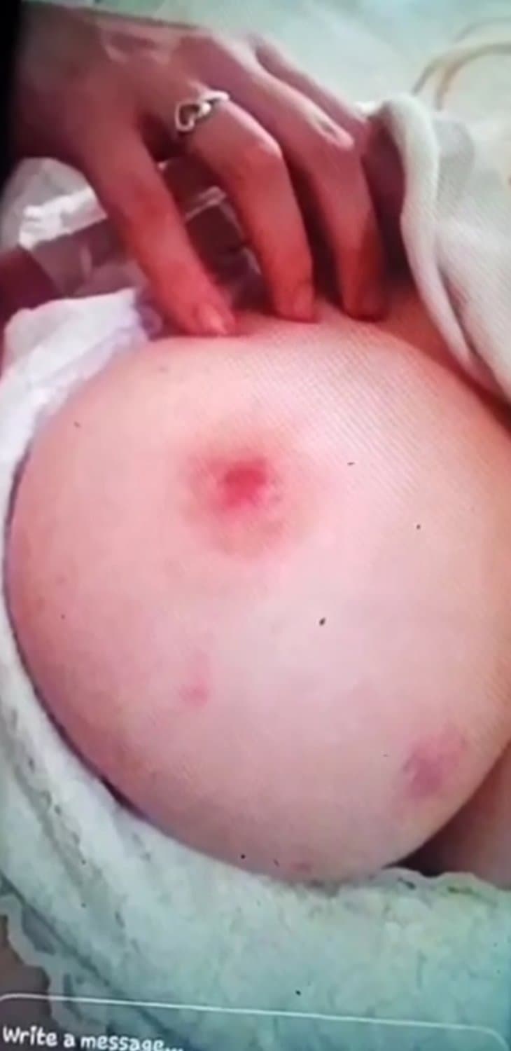 OC I gave her a hickey after fucking her 2 nights in a row because I knew she was a slut