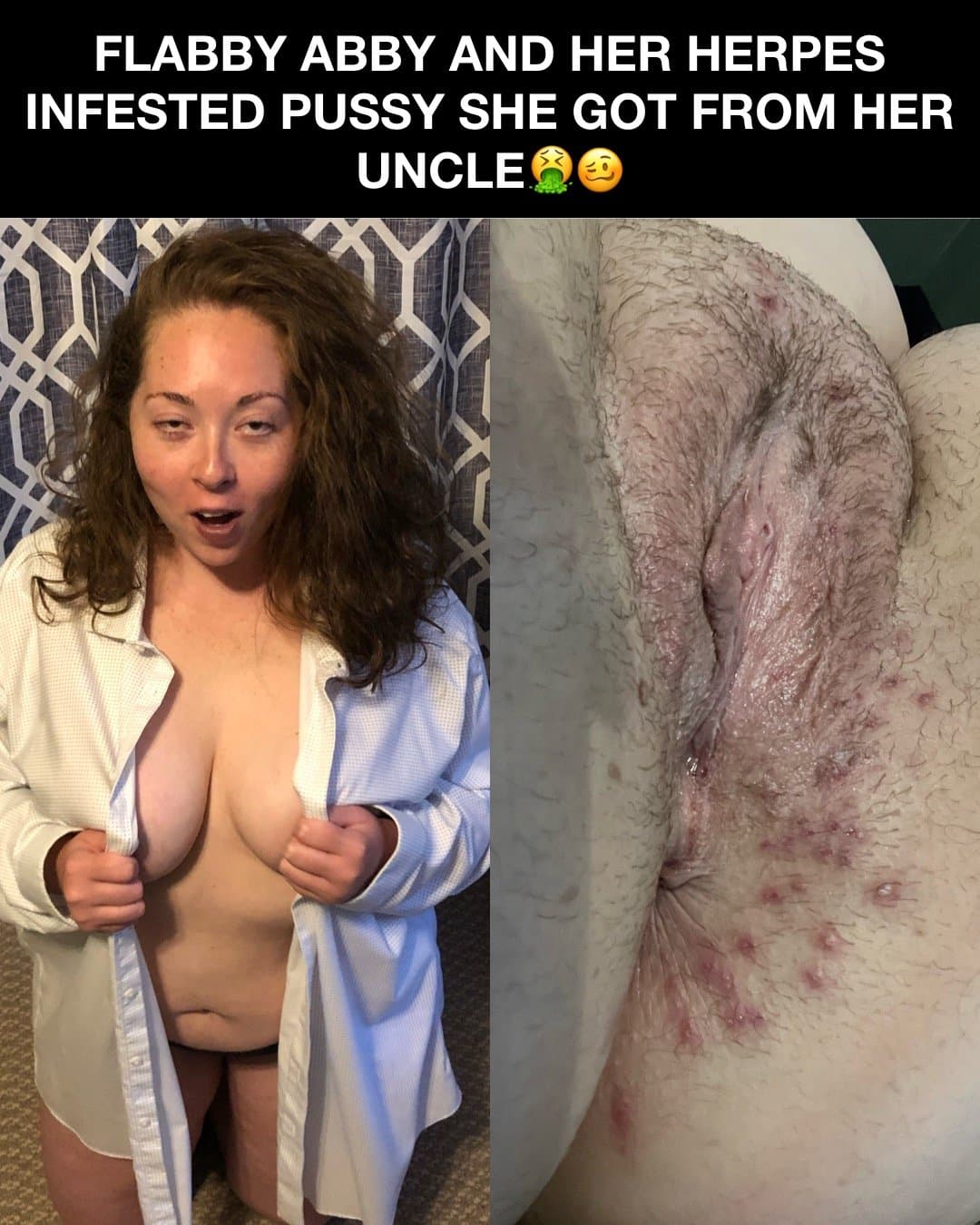 Click to view full size Flabby Abby bred by her Uncle!! Kik: mygirl4usecny