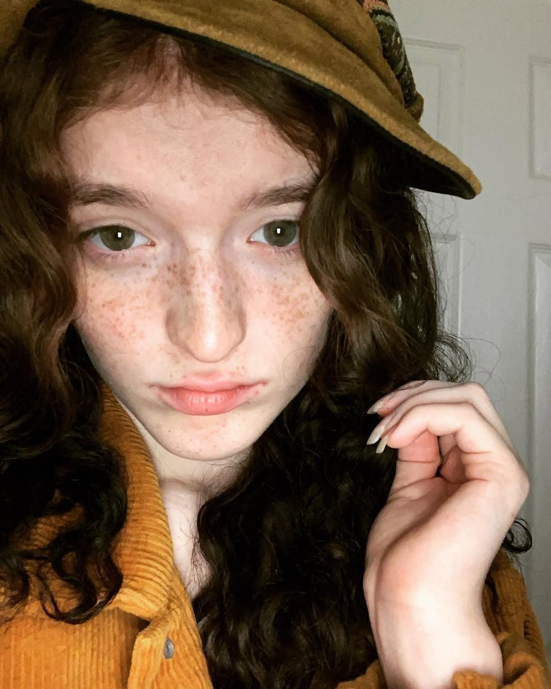 Click to view full size Disclosure #584: ABDL