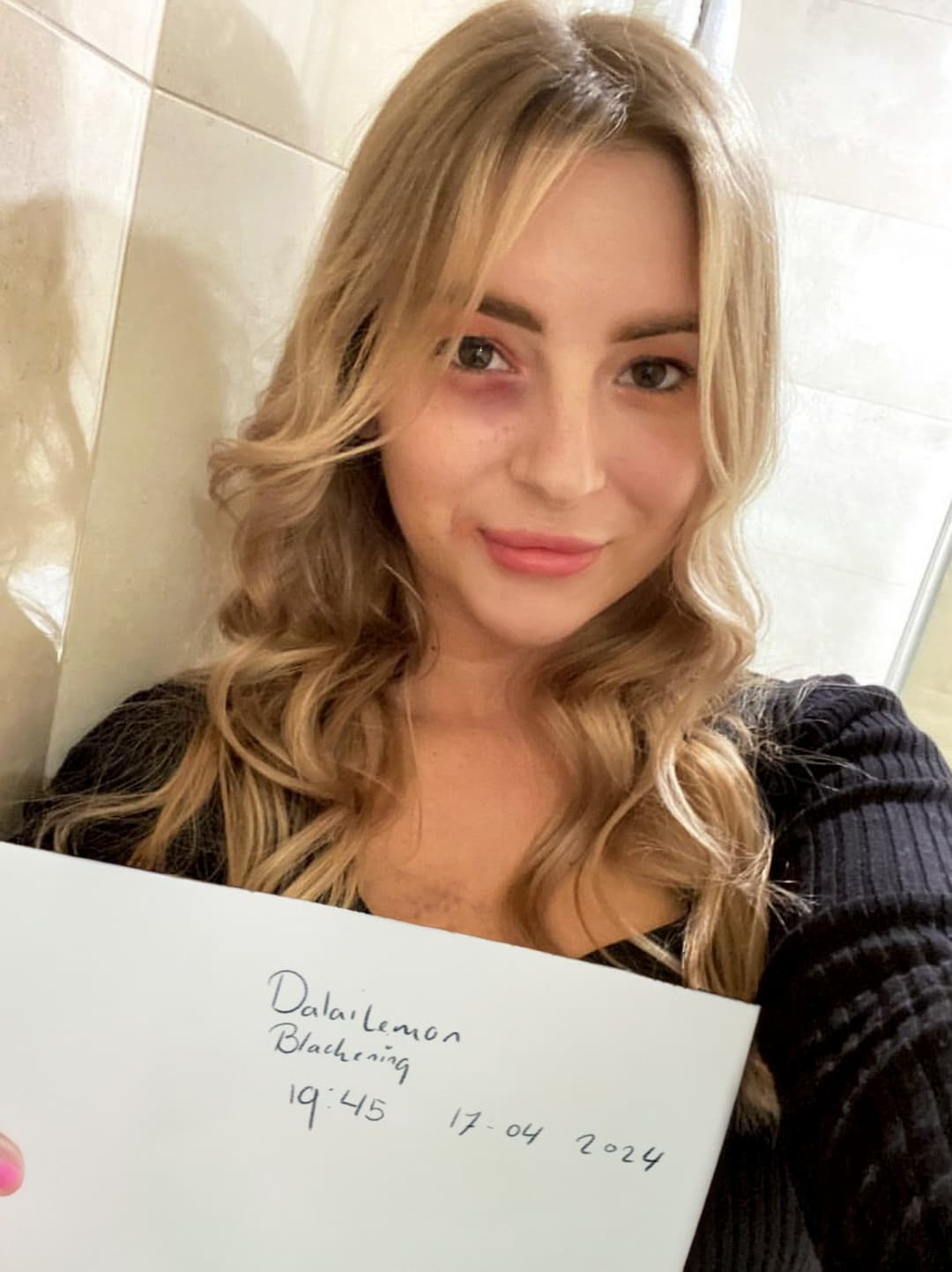 young dutch junkie milf addicted to being a whore kik:mspadna