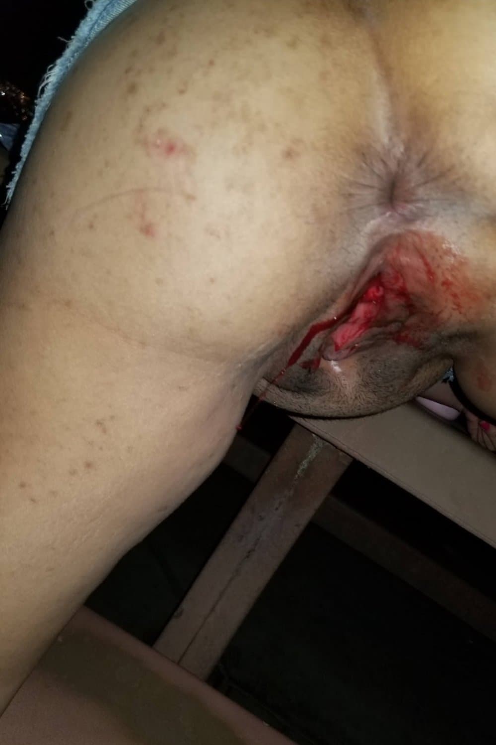 Native Slut Shows Her Period