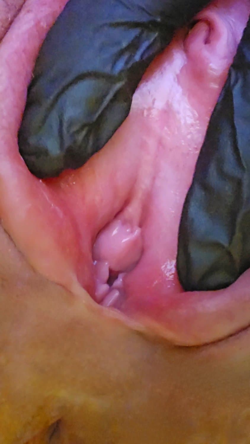 Click to view full size Charlotte spreading her meaty swollen pussy hole. Her KIK: LickMySwollenPus