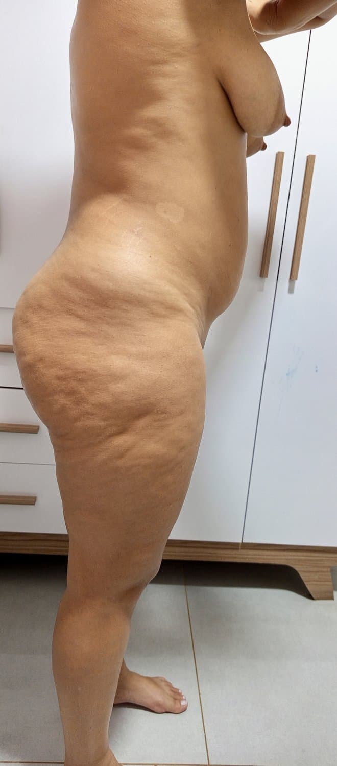 Celulite da esposa (pedidos)