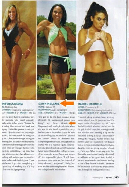 Dawn is a Horny Webslut