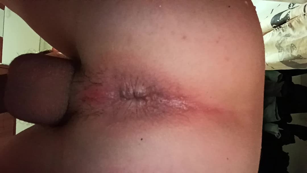 Asshole winking and a little fart ?