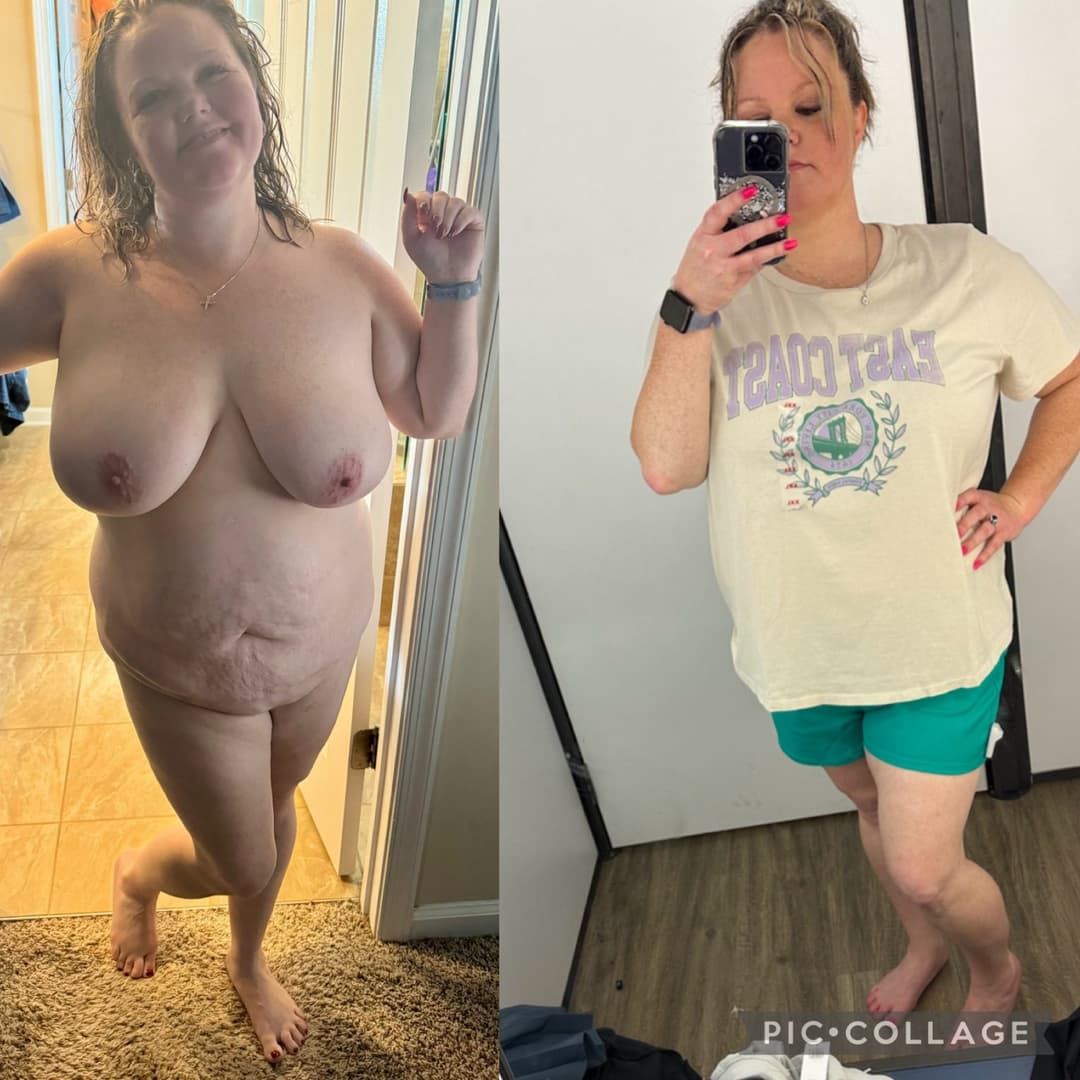 Free Use Amy expanding exposure ?