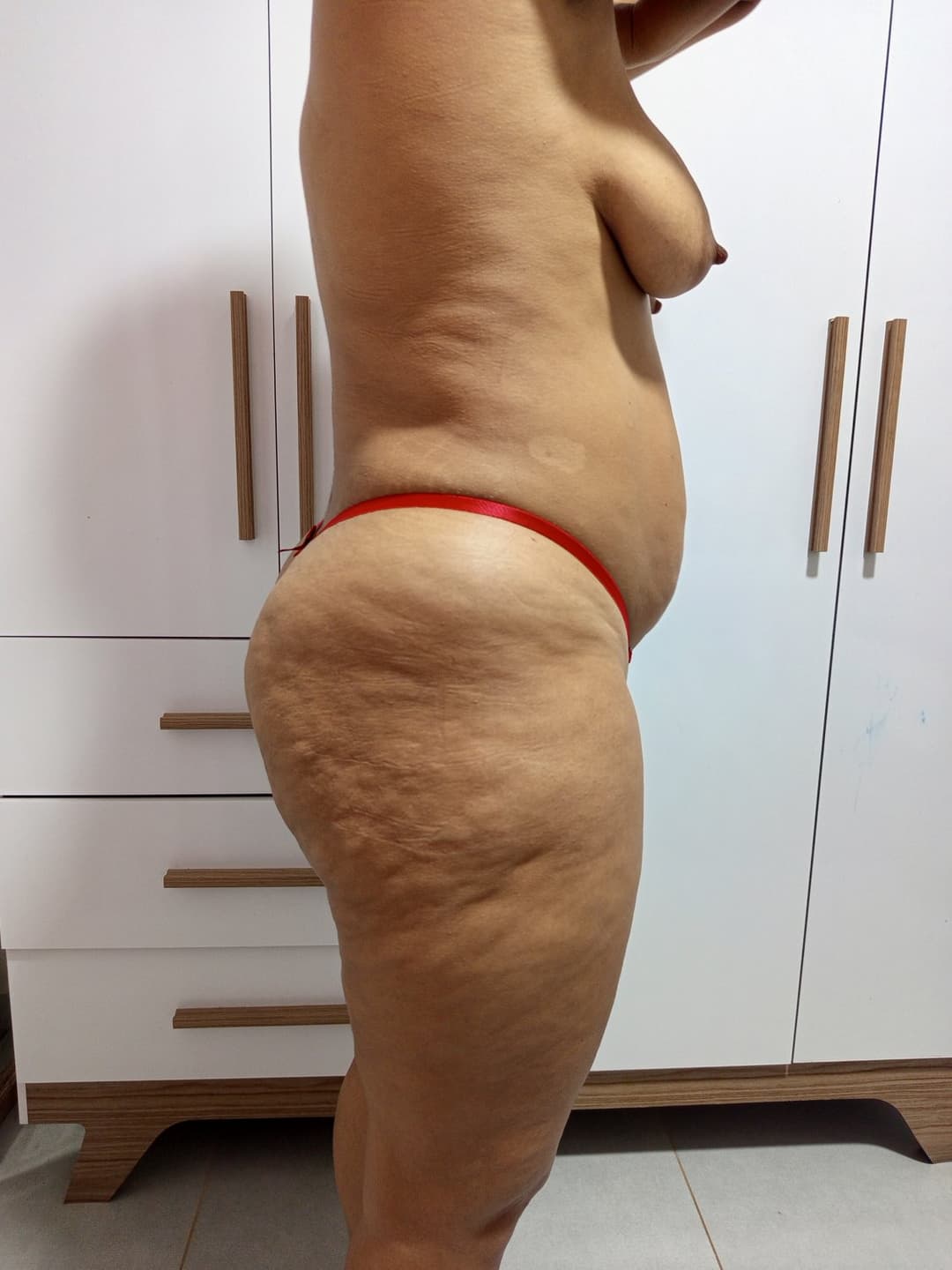 Bundona da esposa com celulite