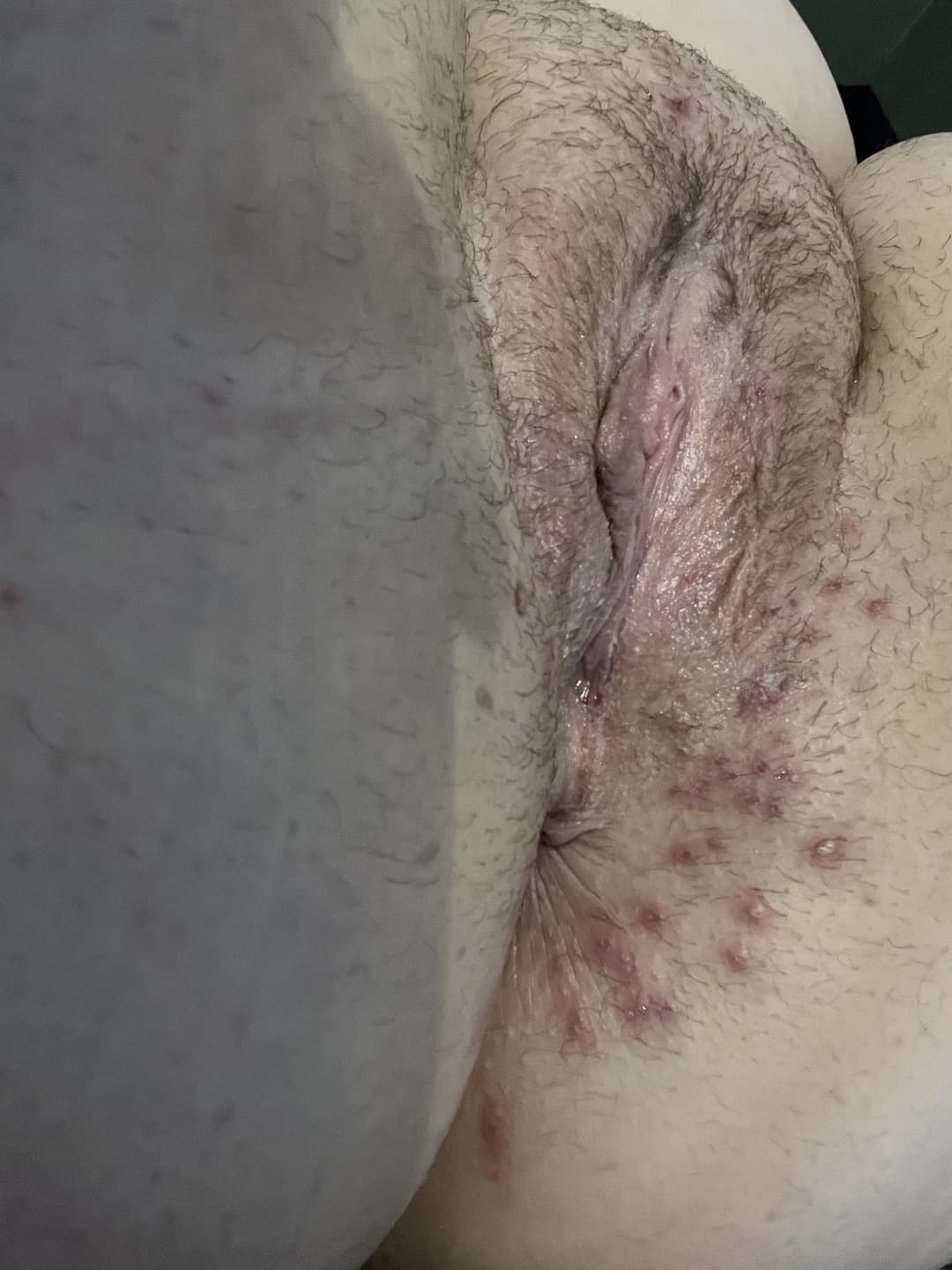 Click to view full size Flabby Abby bred by her Uncle!! Kik: mygirl4usecny