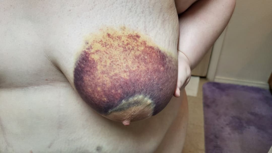 Heavy BDSM Brusing Over A Week