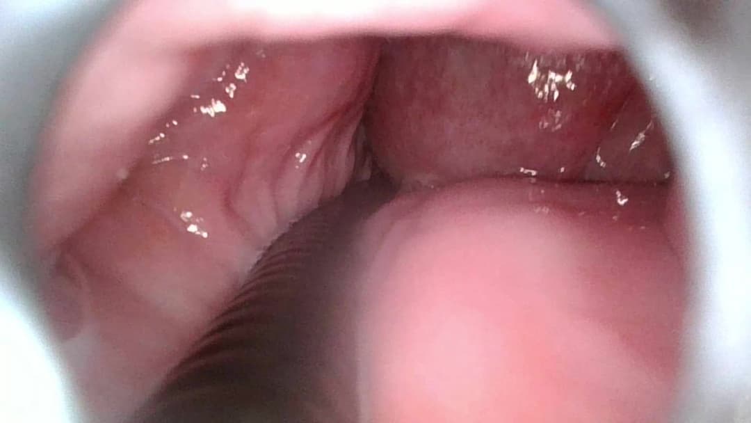 With the endoscope in her vagina, fingered her, licked her, and then insert my penis and cum inside.