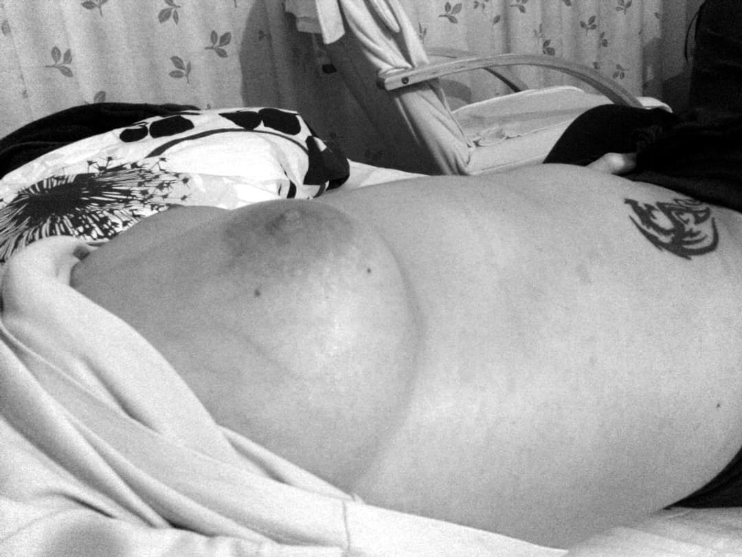 Pregnant Monika. Age: 39. Week 9