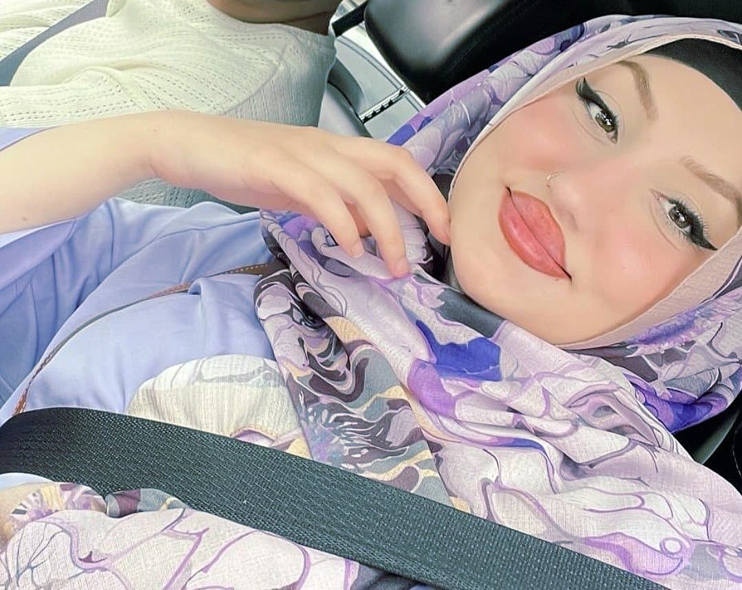 amazing hijab before and after lip lifting