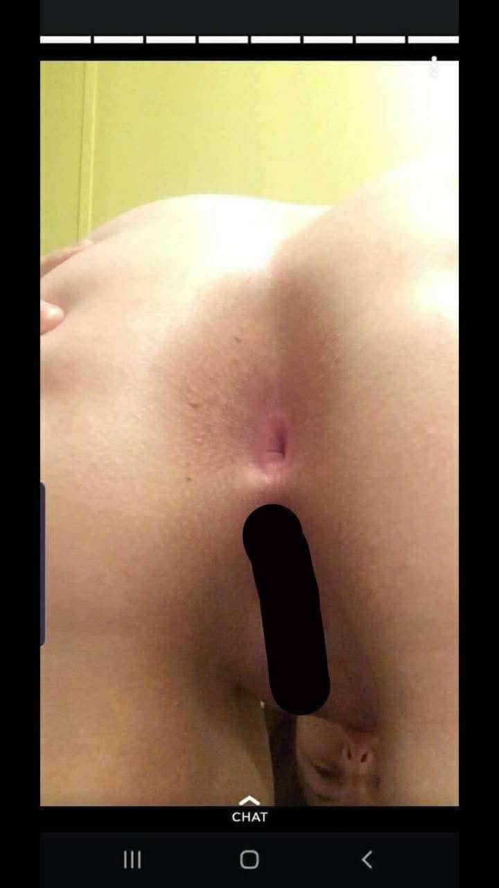 Brace face and her fart dispenser she loves to fart out of