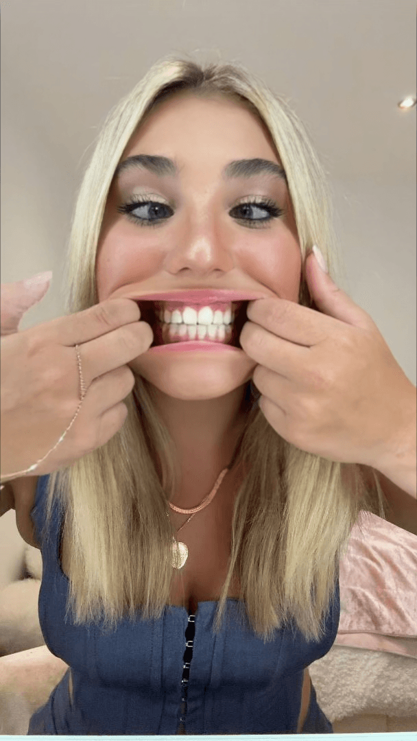 Cross-eyed edits (Dm for custom)