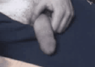 Cocks of Chatroulette (does anybody remember that)