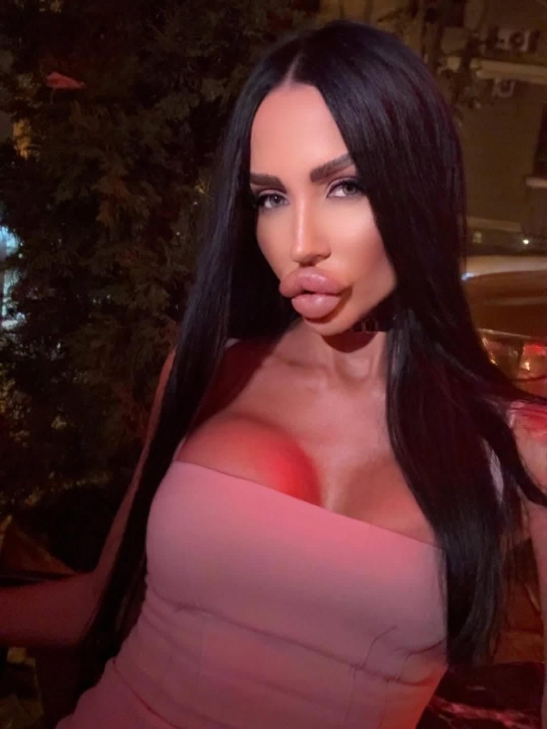 Huge Bimbo Duck Lips