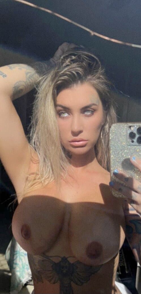 Botched Breast Implants, ??????? ????? Should Sue Her Surgeon