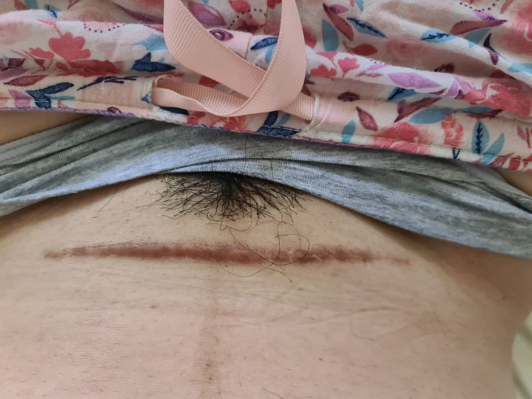 Marilú Bastida, puta embarazada