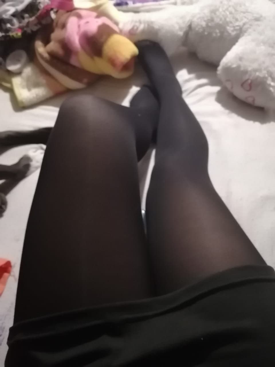 Ana ex alumna de la Unitec Campus Sur quemada por su esposo