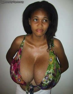 Click to view full size Natasha during Pre-reduction & Pregnancy ?❤️