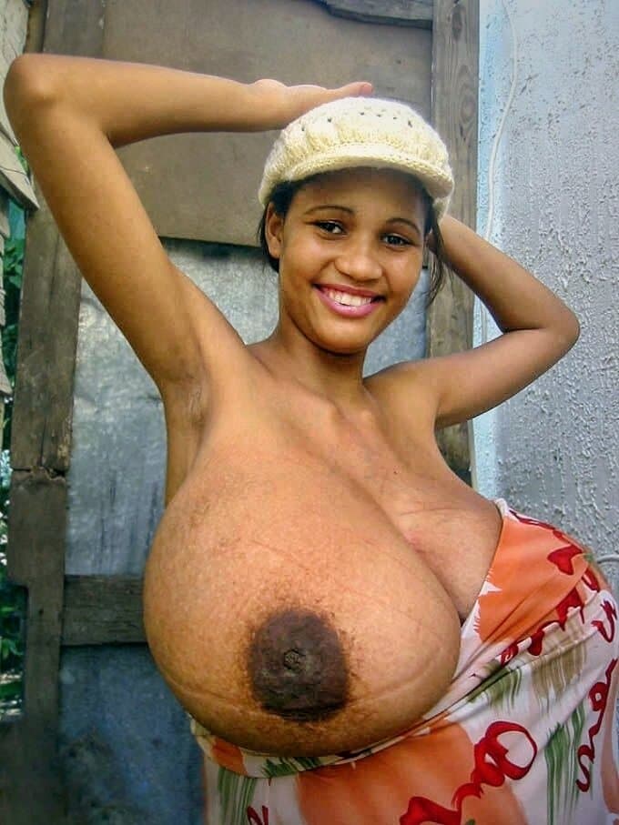 Click to view full size Natasha during Pre-reduction & Pregnancy ?❤️